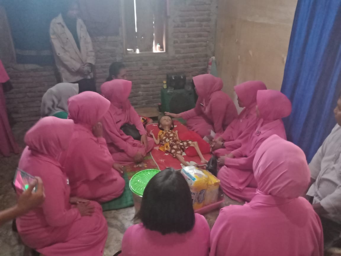 Ketua dan rombongan ibu ibu Bhayangkari Cabang Bantaeng saat di rumah Nurul (8) bocah penderita Hidrosefalus. 