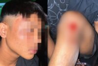 AS usai dikeroyok 10 orang dewasa 10 orang lebih. (Foto: dok, pribadi)