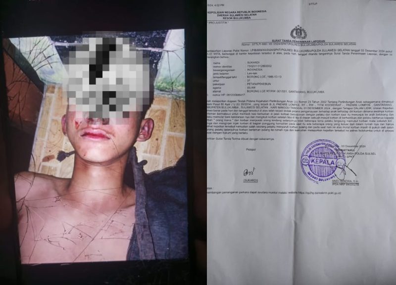 Kondisi AF (17), Babak belur usai dianiayai di Desa Bialo Kabupaten Bukukumba. (FOTO:Kolase)