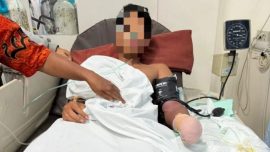 Pelajar SMK Dibacok Begal Saat Nongkrong, Pergelangan Tangan Putus