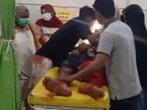 Pria di Pangkep Ditebas Parang Saat Pesta Miras Pasca Lebaran, Ini Motif dan Kronologinya