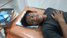 Sebulan Berlalu, Pelaku Penganiayaan Brutal di Dolangang Pinrang Belum Ditangkap