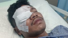 Pria di Baubau Ditetapkan Tersangka Usai Dibacok Hingga Buta Permanen